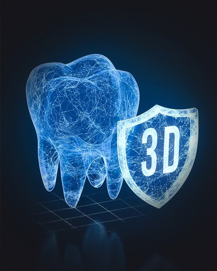 Implanturi ghidate 3D