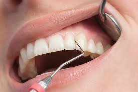 Estetica gingiilor